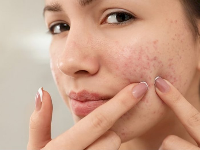 Kulit Tetap Bermasalah? Ini 4 Alasan Skincare Kamu Gak Mempan