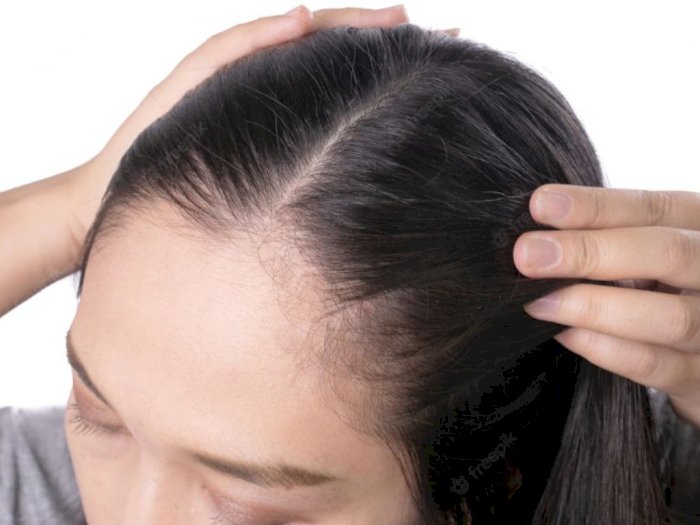 Rambut Sering Rontok Bisa Bikin Cepat Botak, Benarkah?