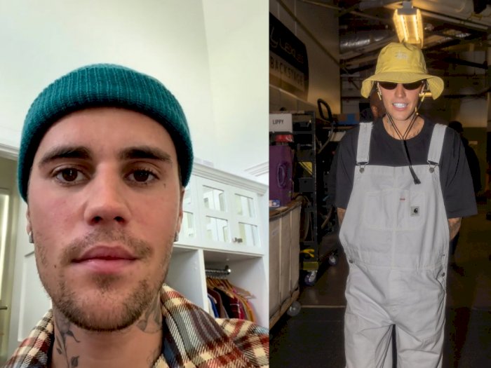 Ahli Bedah Sebut Kondisi Justin Bieber Menunjukkan Tanda-Tanda Awal Pemulihan