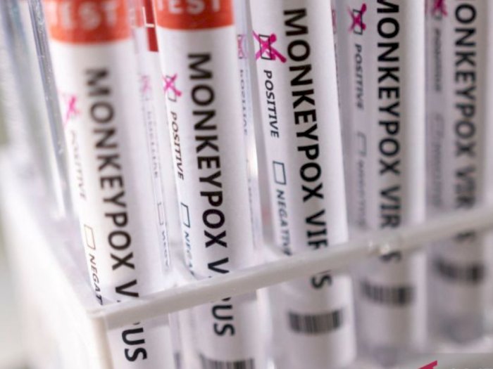 Lawan Cacar Monyet, Uni Eropa Beli 110 Ribu Dosis Vaksin, Disinyalir dari Imvanex Denmark