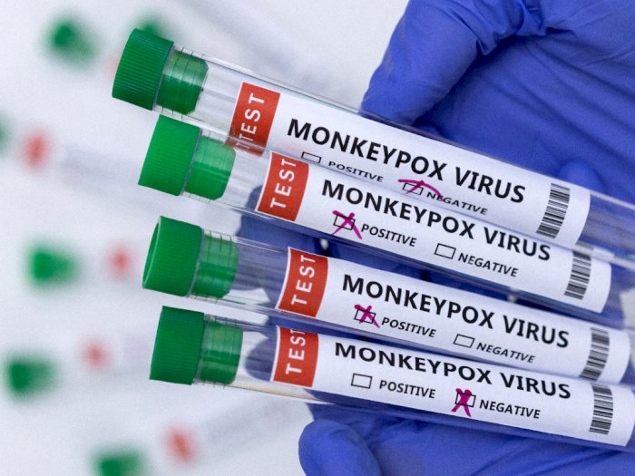 Kasus Cacar Monyet di Inggris Mengamuk, 793 Infeksi Dilaporkan