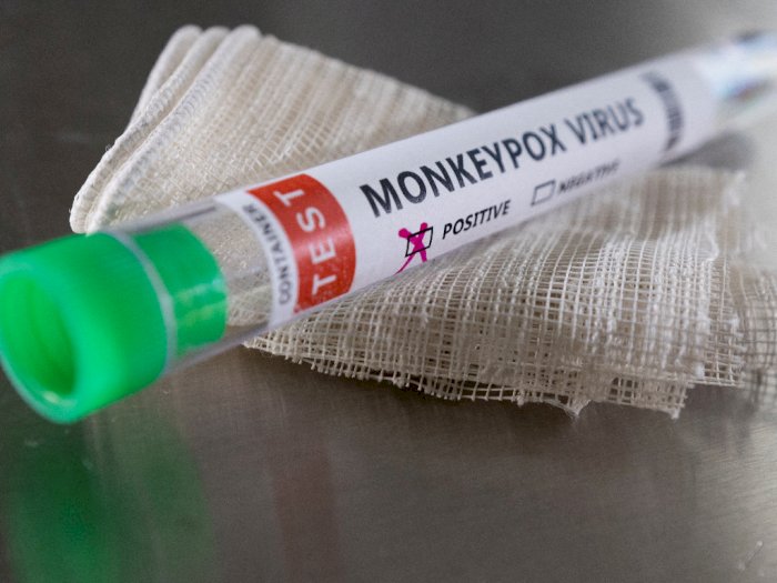 Vaksin AstraZeneca Diklaim Jadi Penyebab Cacar Monyet, Benarkah?