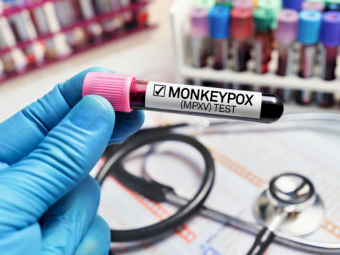 Peneliti Korsel Kembangkan Alat Tes PCR Khusus Cacar Monyet, Hasil Keluar dalam 90 Menit