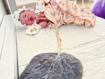 Jangan Buru-buru Potong Plasenta Usai Bayi Lahir, Ternyata Ini Manfaatnya