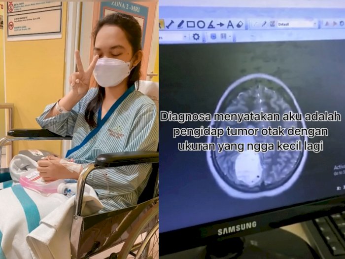 Curhat Gadis Muda Kena Tumor Otak, Sempat Dikira Salah Bantal karena Pusing & Sakit Leher