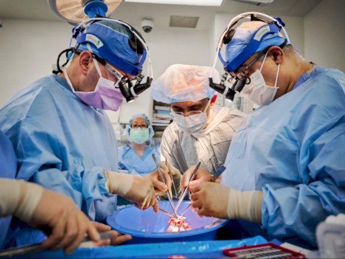 Wow! Jantung Babi Sukses Ditransplantasikan pada 2 Pasien Mati Otak, Ini Kata Peneliti