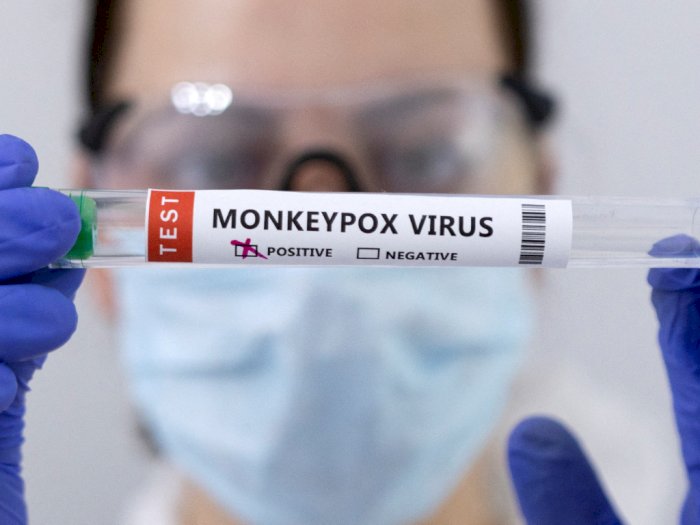 Kemenkes Perluas Laboratorium Penelitian Virus Monkeypox Meski Kasus di Indonesia Nihil