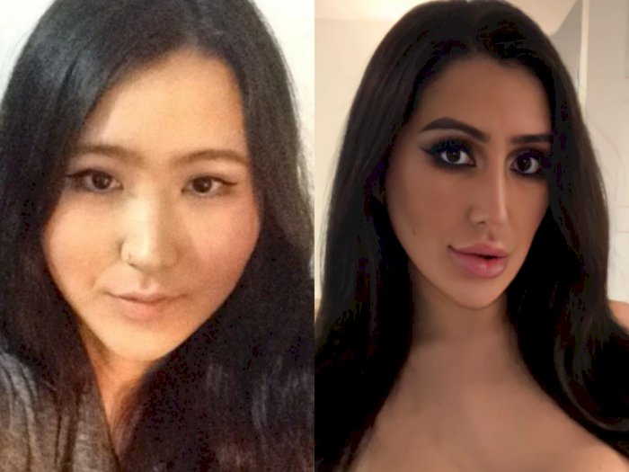 Terobsesi Kim Kardashian, Guru di Korsel Habiskan Rp900 Juta untuk Operasi Plastik