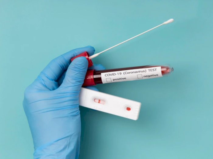 Ngilu! 2 Pebulutangkis Indonesia Alami 'Insiden Berdarah' saat Tes PCR di Jepang