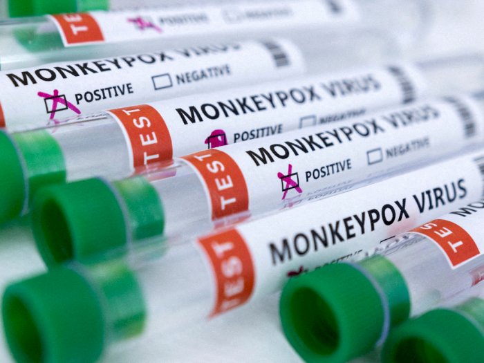 Kasus Cacar Monyet Pertama Ditemukan, DPR Dorong Pemerintah Siapkan Vaksin