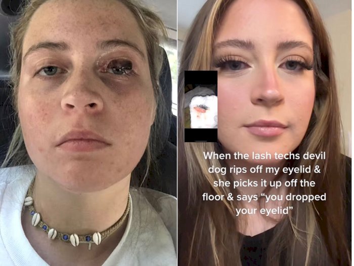 Ngilu! Pasang Eyelash Extension, Kelopak Mata Wanita Ini Malah Digigit Anjing di Salon