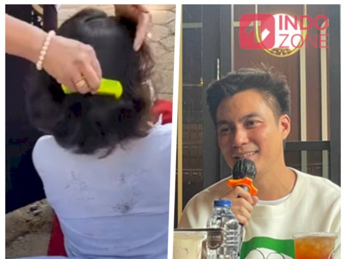 Baim Wong Bakal Temui Bocah SD Viral Penuh Kutu di Rambutnya: Saya Mau Apresiasi Gurunya