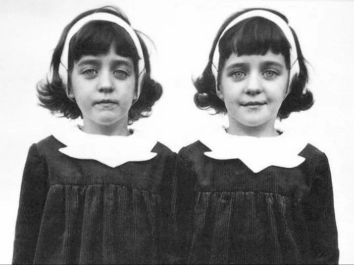 Misteri Reinkarnasi Gadis Kembar yang Tewas dalam Kecelakaan: Kisah Nyata Pollock Twins