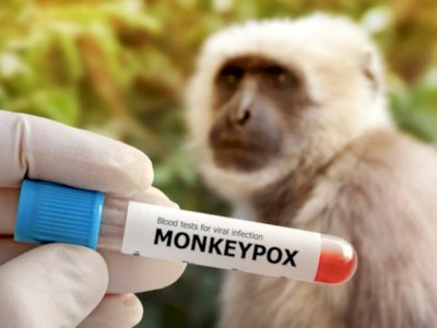 Studi: Cacar Monyet Bisa Memicu Pembengkakan Otak dan Kelumpuhan