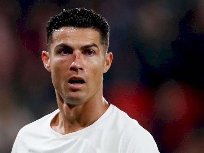 Ronaldo Umur 37 Masih Ambisius Cetak Gol, Kejar Bola hingga Hidung Berdarah