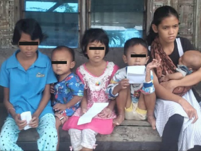 Tolong! Baru Ditinggal Ayah, Lima Anak Yatim di Medan Diduga Terpapar Cacar Monyet