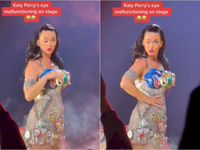 Mata Kanan Katy Perry Tertutup Sendiri saat Konser, Diduga karena Sindrom Ramsay Hunt