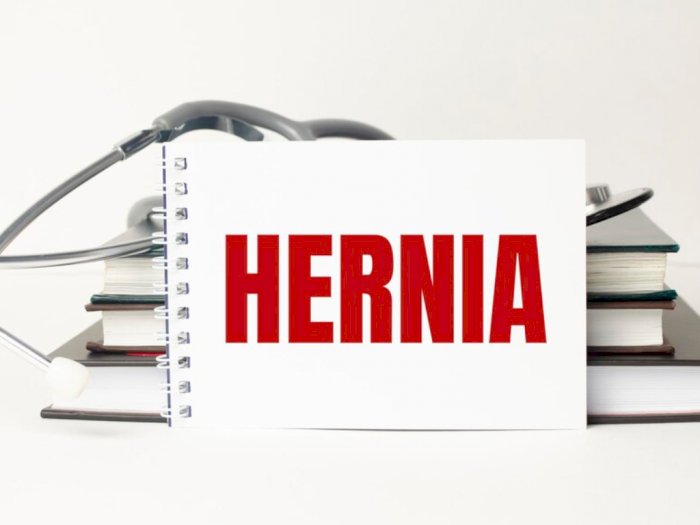 Hernia: Jenis, Gejala, Penyebab hingga Cara Mengobatinya