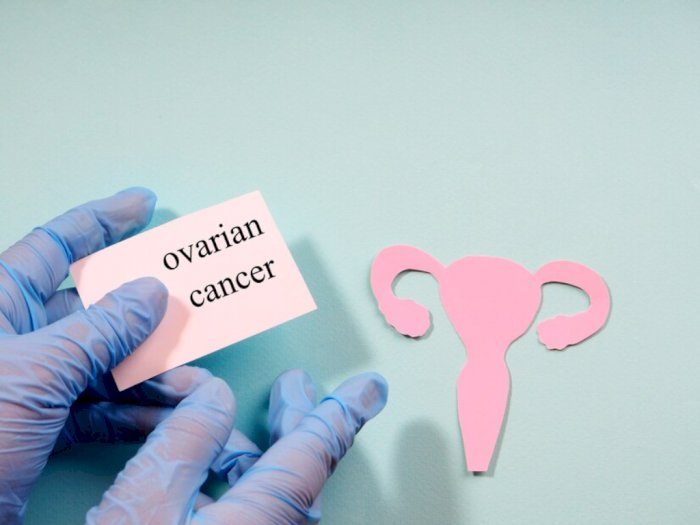 Apakah Kista Ovarium Bisa Berkembang Menjadi Kanker? Ini Penjelasan Dokter