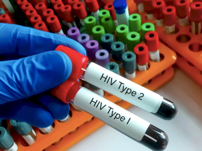 Hasil Tes HIV Negatif usai Konsumsi ARV 3 Bulan, Begini Penjelasan Prof Zubairi Djoerban