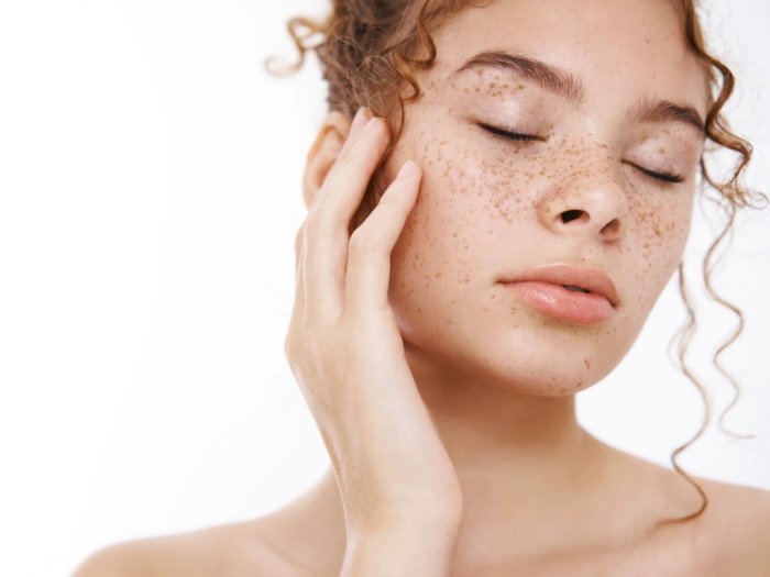 Apa Sih Penyebab Flek Hitam dan Cara Mencegahnya? Ini Jawaban Dokter Kecantikan