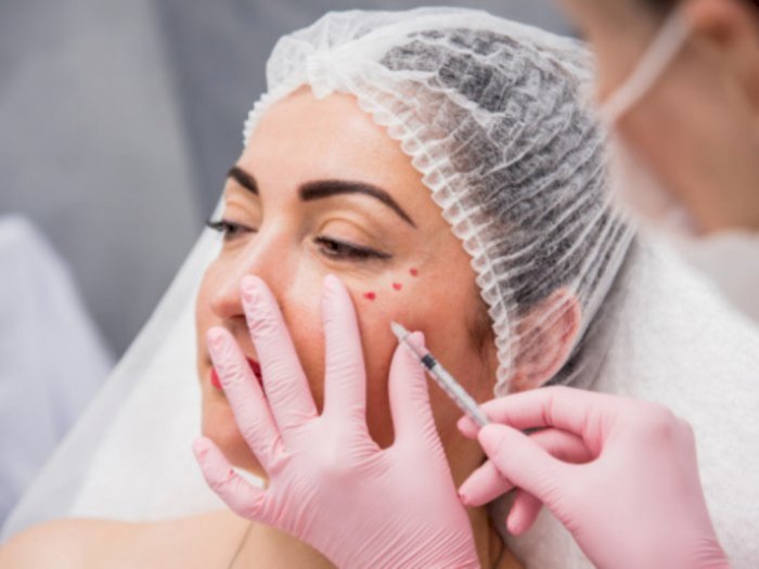 Botox dan Filler Disebut Jadi Tren Perawatan Wajah yang Paling Diminati Selama 2022