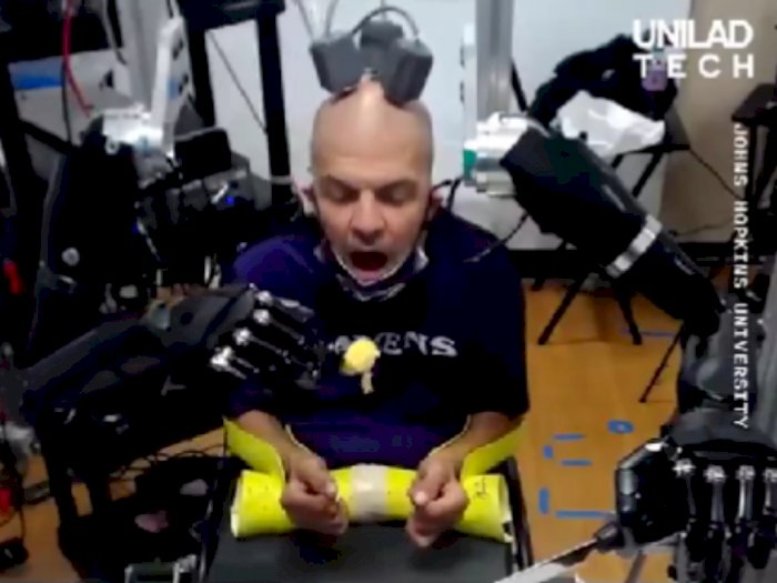 Penderita Quadriplegia Andalkan Robot AI yang Diatur dari Pikirannya untuk Beraktivitas