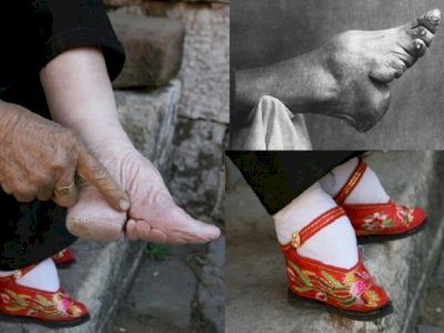 Tradisi Mengikat Kaki ala Wanita Tiongkok, Cara Menyakitkan untuk Jadi Cantik & Dihormati