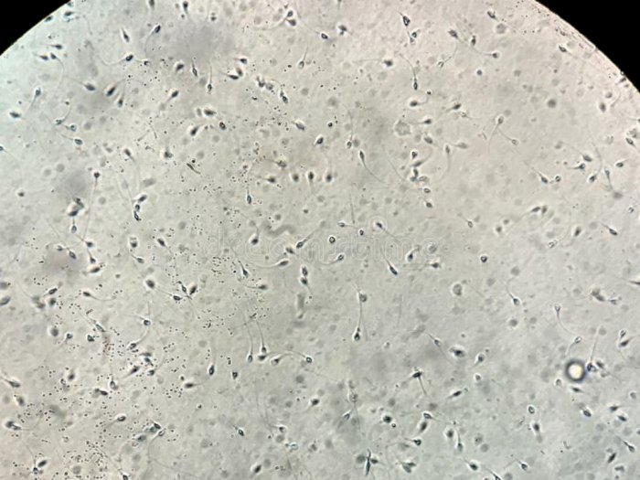 Penampakan Sperma Diperbesar Saat Dilihat dari Mikroskop, Komentar Netizen Bikin Kocak