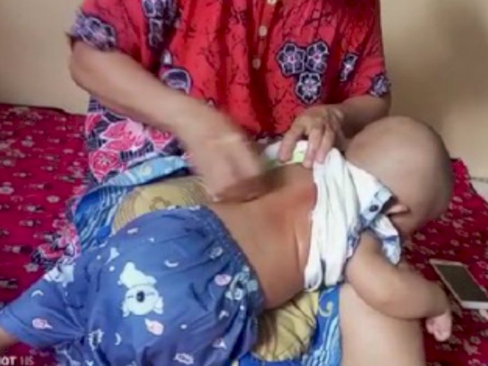 Viral Ibu Pamer Tubuh Anaknya Kerokan Sampai Merah, Netizen: Ibu-Ibu Sekarang Kenapa Sih