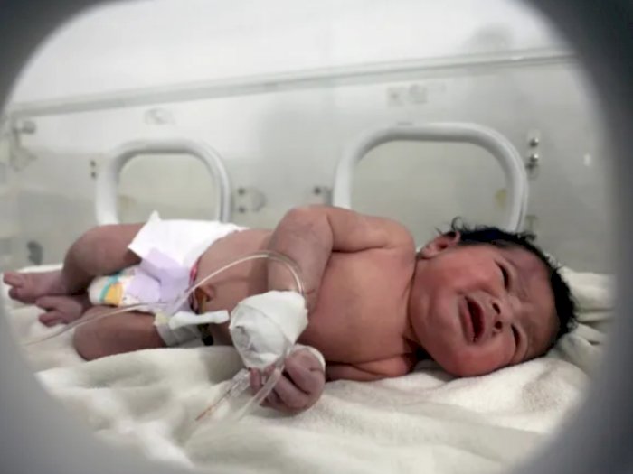Masih Terikat Tali Pusar, Bayi Baru Lahir Ini Selamat dari Reruntuhan Gempa di Suriah