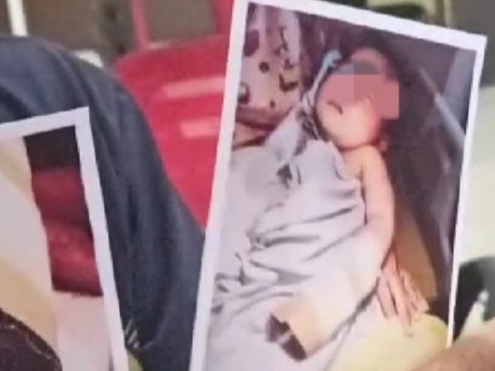 Gunting Jari Bayi hingga Putus, Perawat di Palembang Terancam Penjara 5 Tahun