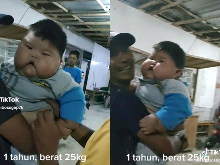 Viral Balita 1 Tahun Punya Berat Badan 25 Kg, Dokter Jelaskan Bahaya Obesitas pada Anak