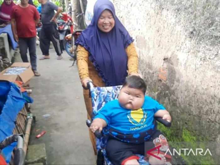 Menkes Budi akan Dampingi Balita Obesitas di Bekasi: Pasti Ada Sesuatu, Harus Dirawat!