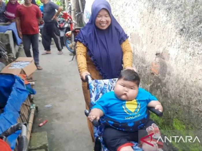 Viral Balita Obesitas 27 Kg di Bekasi, Dokter Gizi Soroti Pola Makan Keluarga