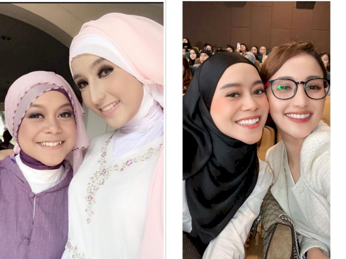 Foto Jadul vs Terbaru Lesti Kejora, Netizen: Gigi Masih Kuning dan Kulit Item Natural