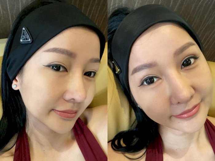 Lucinta Luna Pamer Hidung Buatan yang Dikritik Kegedean: Kamu Lakik Mas