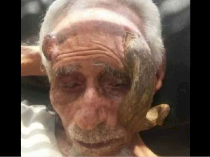 Pria 140 Tahun Meninggal Usai Tanduknya Coba Dipotong