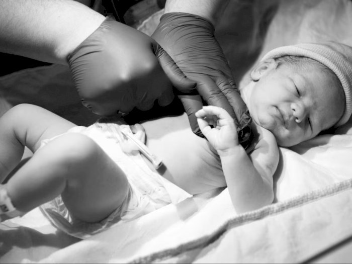 Bayi Prematur Bisa Tumbuh Kembang dengan Baik seperti Anak Normal, Perhatikan Hal Ini