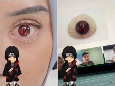 Wibu Sejati! Wanita Ini Ganti Mata Jadi Model Sharingan seperti di Naruto