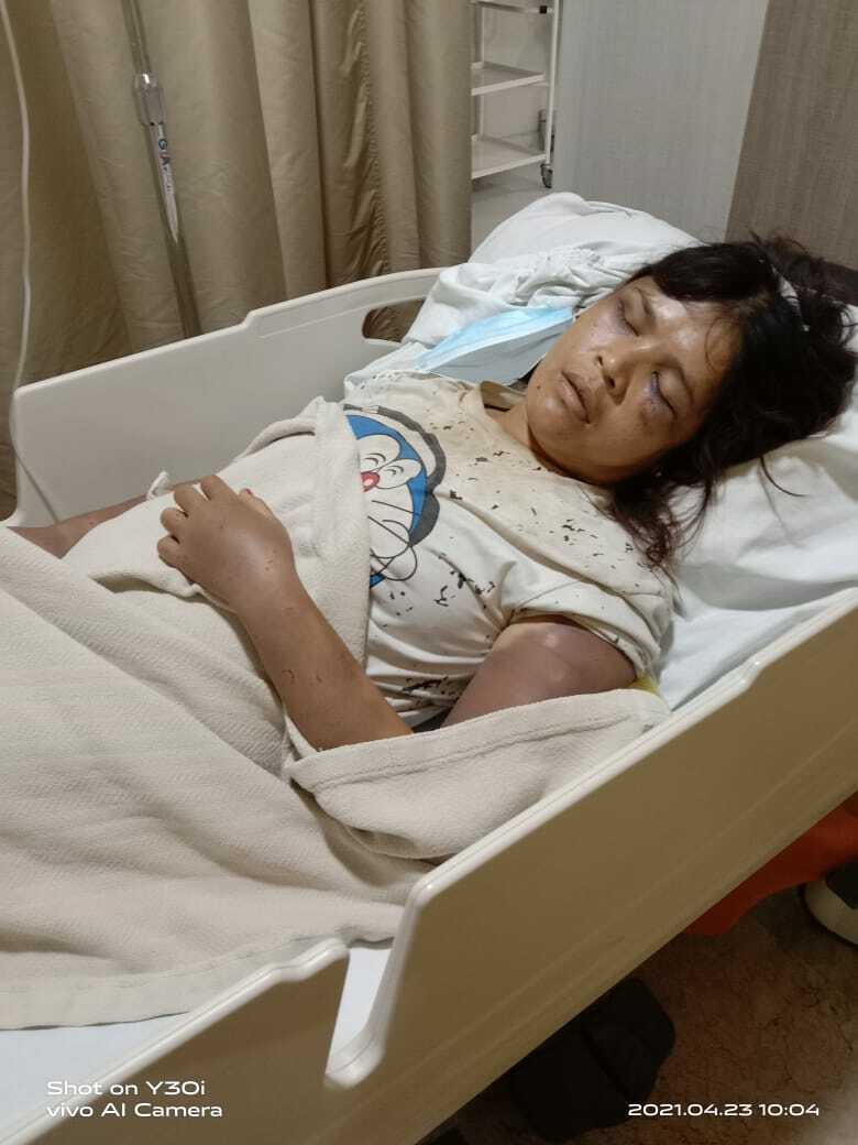Rina Lesmana boru Simanungkalit korban penganiayaan (Ist.) Rina Lesmana boru Simanungkalit korban penganiayaan