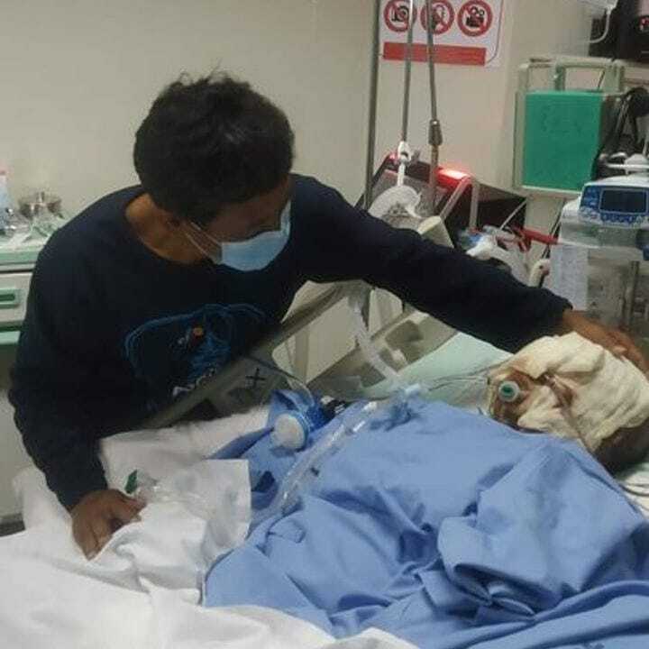Indah Daniarti saat menjalani perawatan akibat luka bakar. (KitaBisa) Indah Daniarti saat menjalani perawatan akibat luka bakar. (KitaBisa)