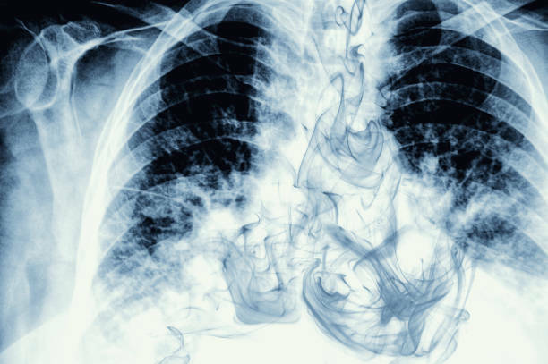 Bahaya vape meningkatkan risiko kanker (photo/istock/brightstars) bahaya vape