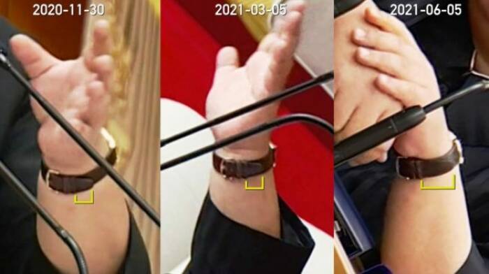 Jam tangan yang dipakai Kim Jong Un kini lebih ketat. (NKNews) kim jong un makin kurus
