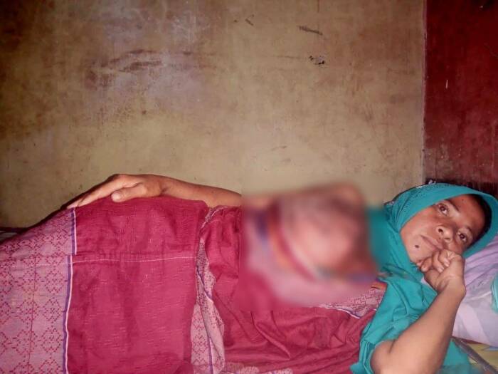 (Photo/Insan Bumi Mandiri) berjuang melawan kanker payudara