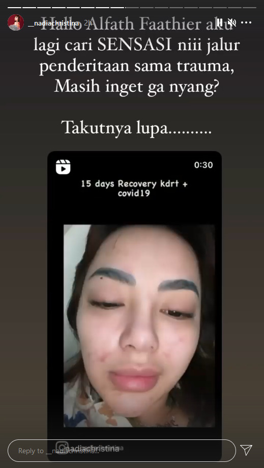 Insta Story Nadia Christina. (Instagram/__nadiachristina) Nadia Christina