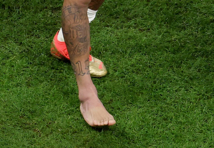 Kaki Neymar yang mengalami cedera di Piala Dunia 2022