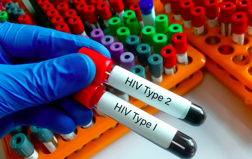 Ilustrasi sampel pemeriksaan HIV/AIDS. 