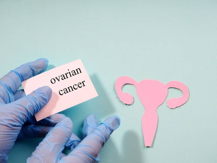 kanker ovarium.